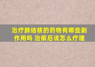 治疗肺结核的药物有哪些副作用吗 治瘉后该怎么疗理